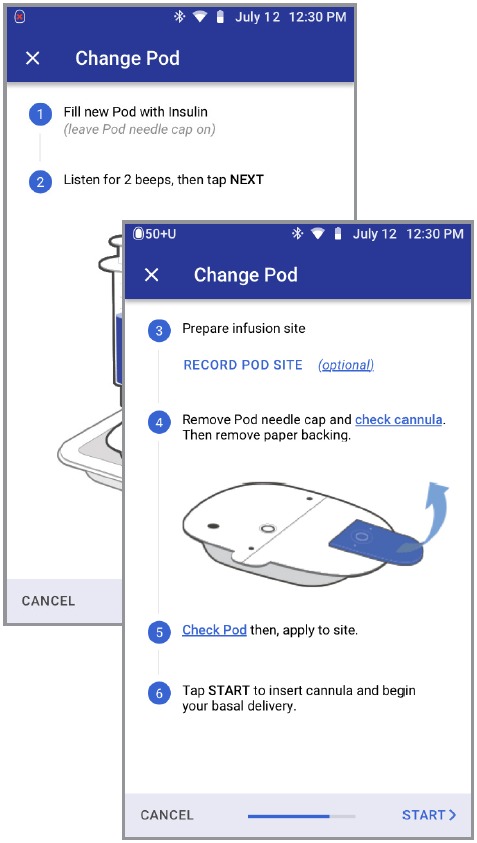 OmniPod - DASH System - SET UP A NEW POD Step 2 SET UP A NEW POD Step 2
