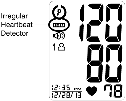 HoMedics - BPA-260-CBL - ЖҮРЕК СОҒУЫНЫҢ БҰЗЫЛУЫН АНЫҚТАҒЫШТЫҢ КӨРСЕТКІШІ ЖҮРЕК СОҒУЫНЫҢ БҰЗЫЛУЫН АНЫҚТАҒЫШТЫҢ КӨРСЕТКІШІ