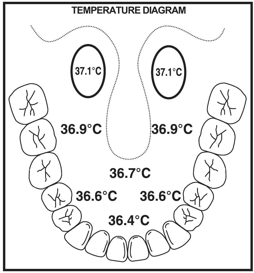 Alecto - BC-19 - HŐMÉRSÉKLET DIAGRAM HŐMÉRSÉKLET DIAGRAM