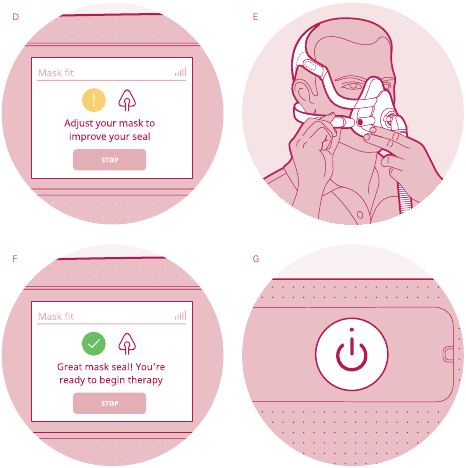 ResMed - AirSense 11 - Подгонка маски - Шаг 2 Подгонка маски - Шаг 2