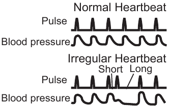 Omron - M3 - Širdies plakimo diagrama Širdies plakimo diagrama