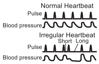 Omron - M3 Comfort - Symbol nepravidelného srdcového tepu Symbol nepravidelného srdcového tepu