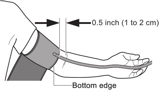 Applicazione del bracciale Fase 2