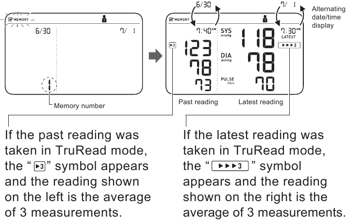 Utilizzo della Funzione Memoria Fase 1