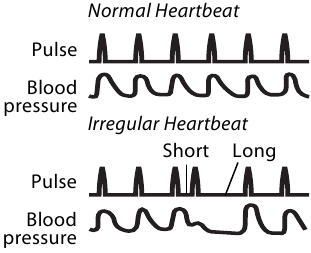 IRREGULAR HEARTBEAT SYMBOL