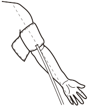 &Ccedil;ALIŞMA TALİMATLARI - MANŞETİN UYGULANMASI Adım 1