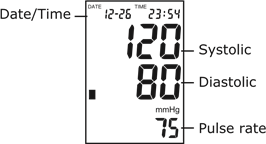 MARRJA E NJ&Euml; MATJEJE