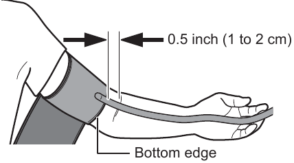 Nasazen&iacute; n&aacute;vleku na paži &ndash; Krok 2