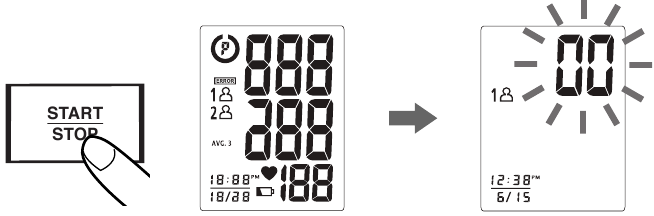 M&Otilde;&Otilde;TMISE PROTSEDUUR &ndash; 2. samm
