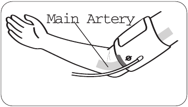 POSTAVLJANJE MANŽETE - Korak 3