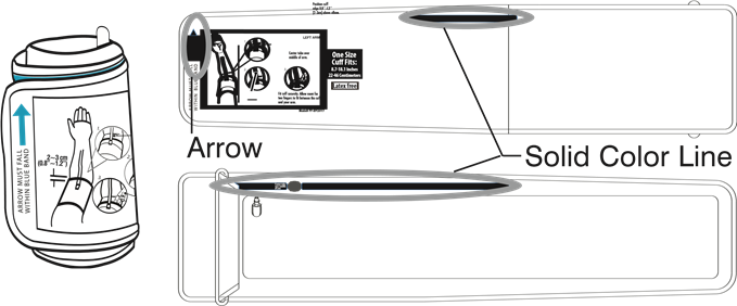 POSTAVLJANJE MANŽETE - Korak 4