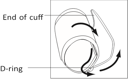 STAVLJANJE MANŽETE - Korak 1