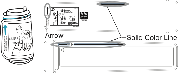 STAVLJANJE MANŽETE - Korak 4