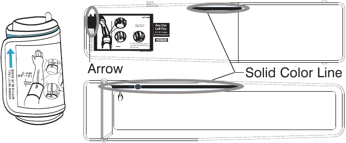 Manjetni qo'llash - 4-qadam - To'g'ri manjet o'lchami