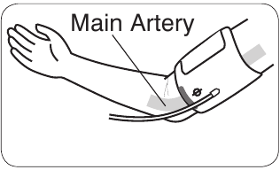 LOCALIZAREA ARTEREI PRINCIPALE