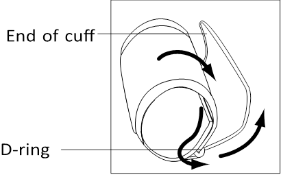 PRIMJENA MANŽETE - 1. korak