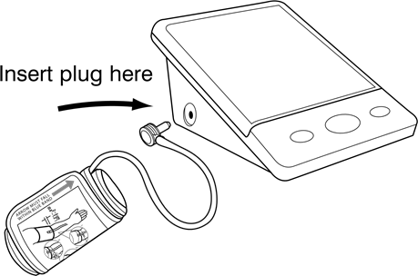 PRIMJENA MANŽETE - 2. korak