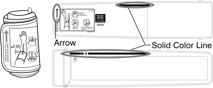 PRIMJENA MANŽETE - 4. korak