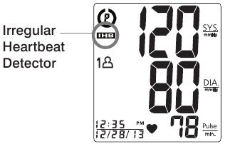 EP&Auml;S&Auml;&Auml;NN&Ouml;LLISEN SYD&Auml;MENLY&Ouml;NNIN TUNNISTIMEN ILMAISU