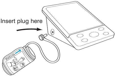POSTAVLJANJE MANŽETE - 2. korak