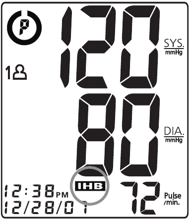 INDIKACIJA DETEKTORA NEPRAVILNIH OTKUCAJA SRCA