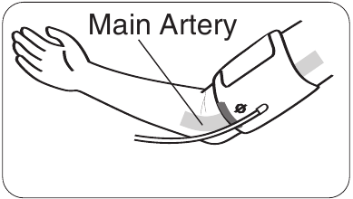 LOCIRANJE GLAVNE ARTERIJE