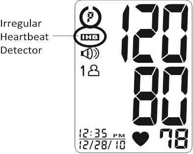 IRREGULAR HEARTBEAT DETECTOR (IHB)