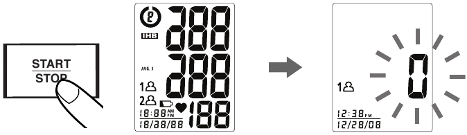 Postupak mjerenja - Korak 2