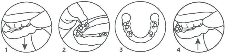 Retainer Brite Instructions.pdf Manual do Retainer Brite da Dentsply Sirona | ManualsLib