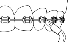 Kjeveortopedisk munnstykke
