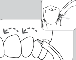 Pik Pocket-munnstykke