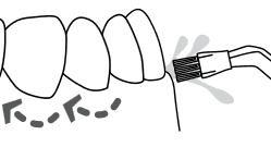 Plaque Seeker-munnstykke