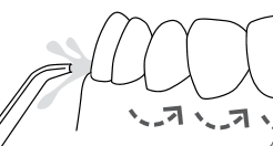 Bruke Water Flosser trinn 2