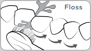 Fogselyem haszn&aacute;lati technika