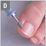 Pointed Filing Cone D