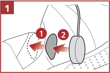 A hangsz&oacute;r&oacute;k &eacute;s a mikrofon beszerel&eacute;se 1. l&eacute;p&eacute;s