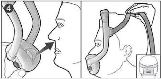 Fitting your mask - Step 1