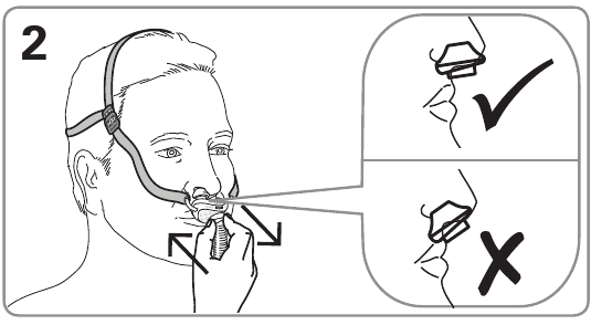 Nasadenie &ndash; 2. krok