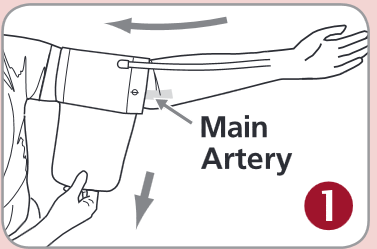 Aplik&aacute;cia manžety - Krok 1