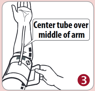 Aplik&aacute;cia manžety - Krok 3