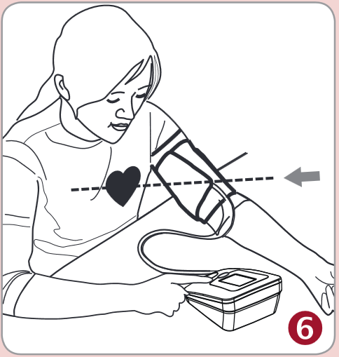 Aplik&aacute;cia manžety - Krok 6