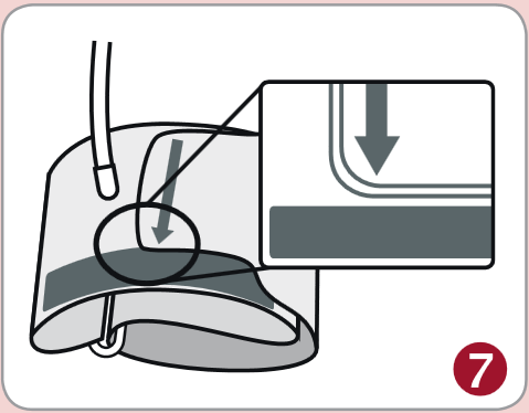 Aplik&aacute;cia manžety - Krok 7