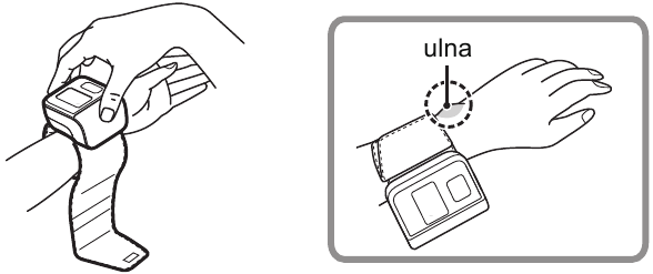 Aplicarea manșetei de &icirc;ncheietură