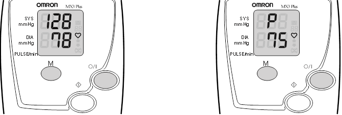 Read display - Step 1