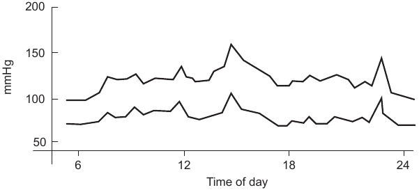 Лечение высокого кровяного давления