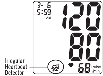 IRREGULAR HEARTBEAT DETECTOR