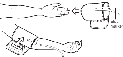 POSTAVLJANJE MANŽETE - 1. korak