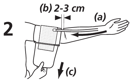 Postavljanje manžete - Korak 1