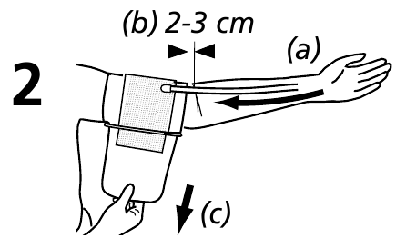 Vendosja e manshet&euml;s - Hapi 1