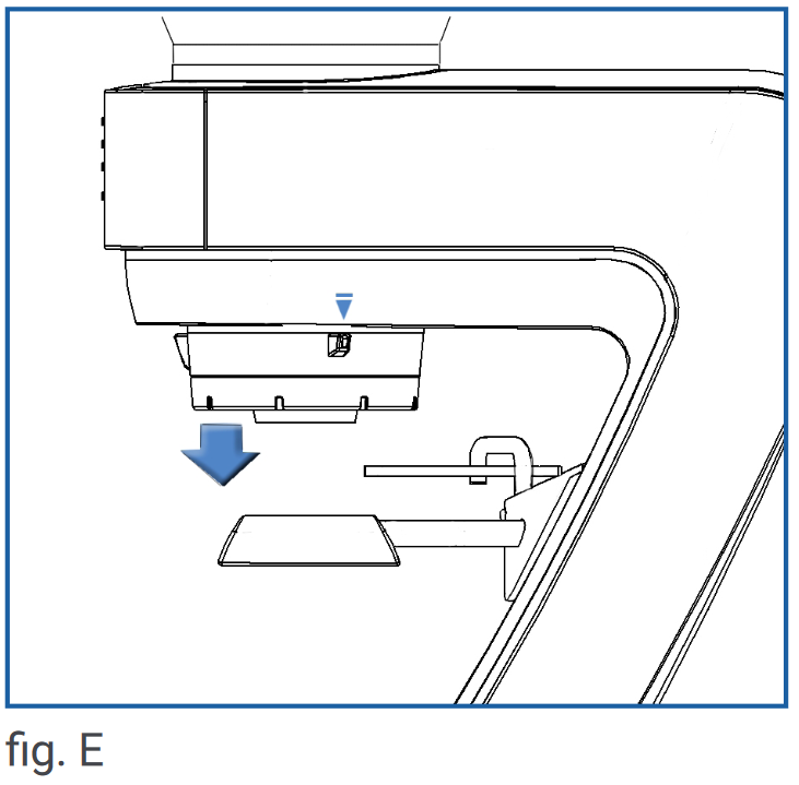 KUONDOA KONI YA KUSAGA/KUREKEBISHA KUSAGA - Hatua ya 3